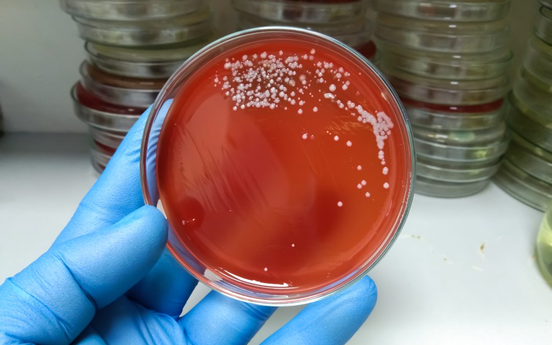 Temprana detección de la “bacteria asesina” es crucial para evitar complicaciones