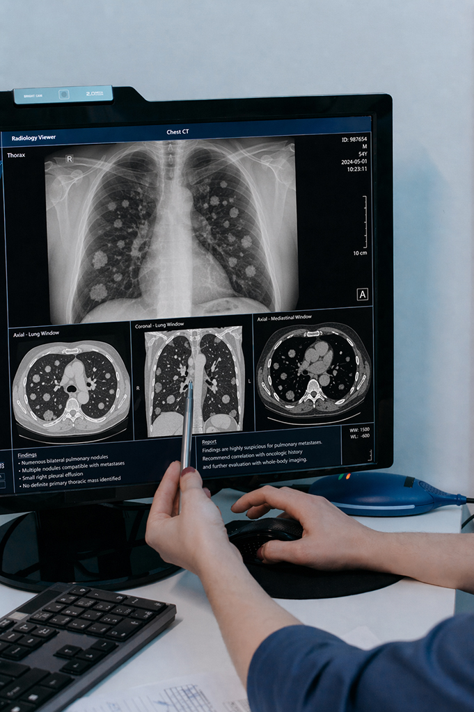 Investigadores crean la primera base de datos latinoamericana para el seguimiento del cáncer con IA