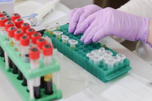 Ministerio de Salud declara Alerta Sanitaria por hantavirus desde Atacama a Magallanes